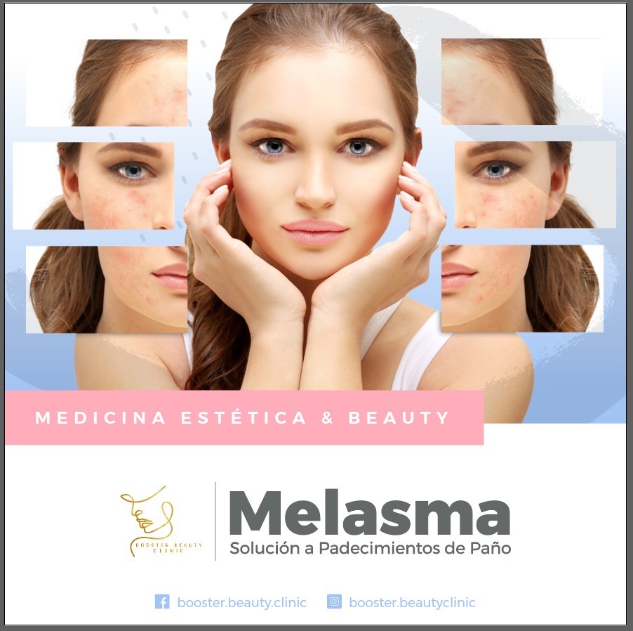 Trabajo Online mkt Booster Melasma